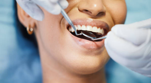 Best Walk-In Emergency Dentist in Kendallville, IN